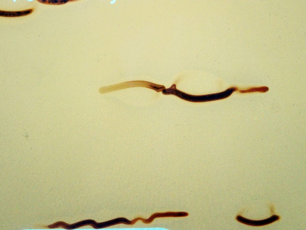 Gunk on a Link. Stains to Explain.